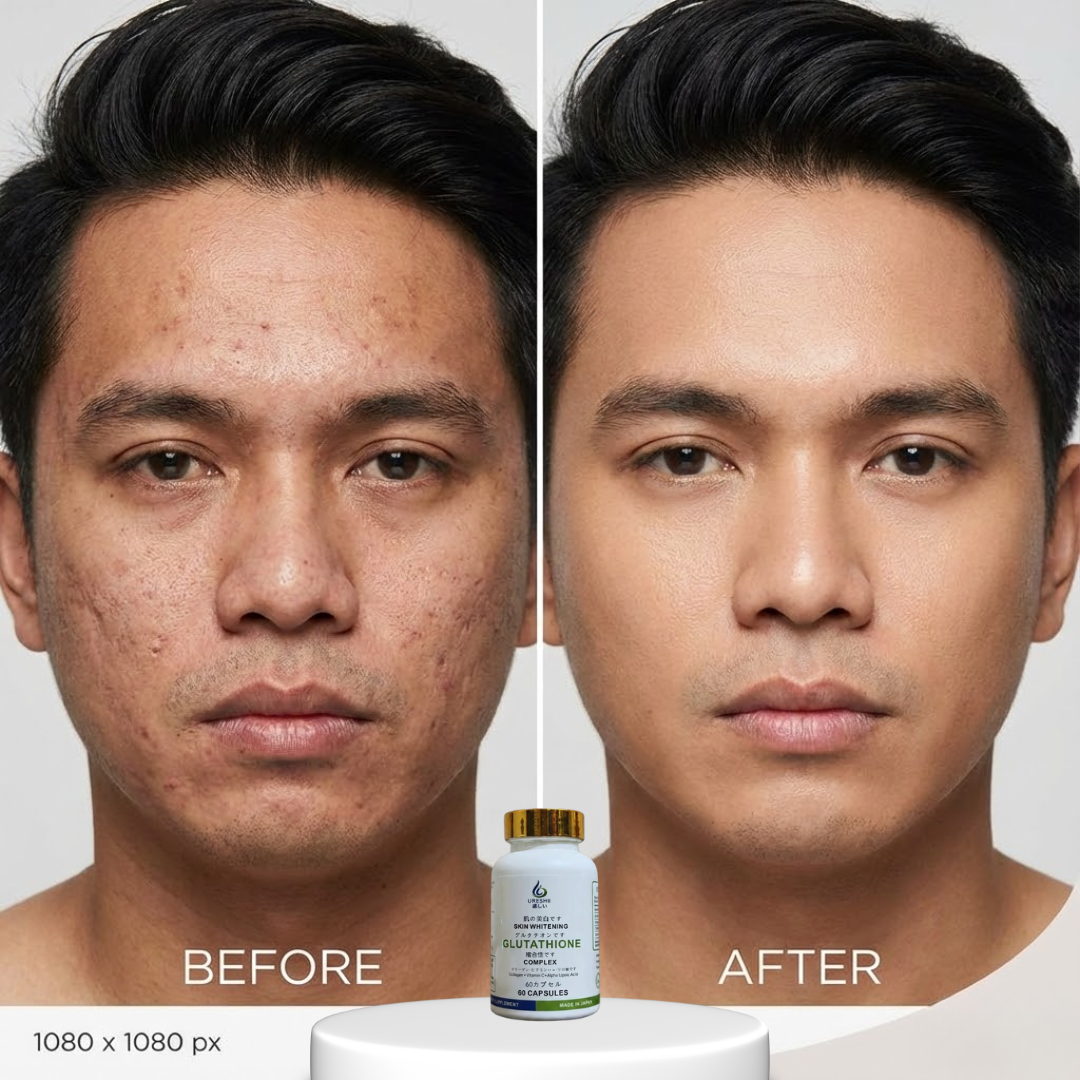 ureshii glutathione Super Whitening Combo Ureshii Glutathione Capsules #fyp #tiktokph